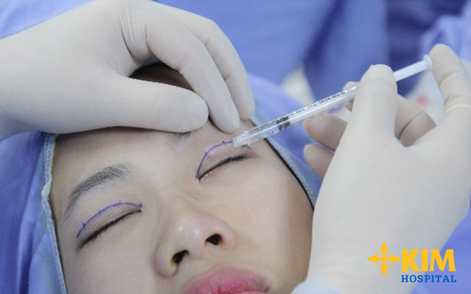 Có cách nào loại bỏ lớp da thừa ở khóe mắt không? 4